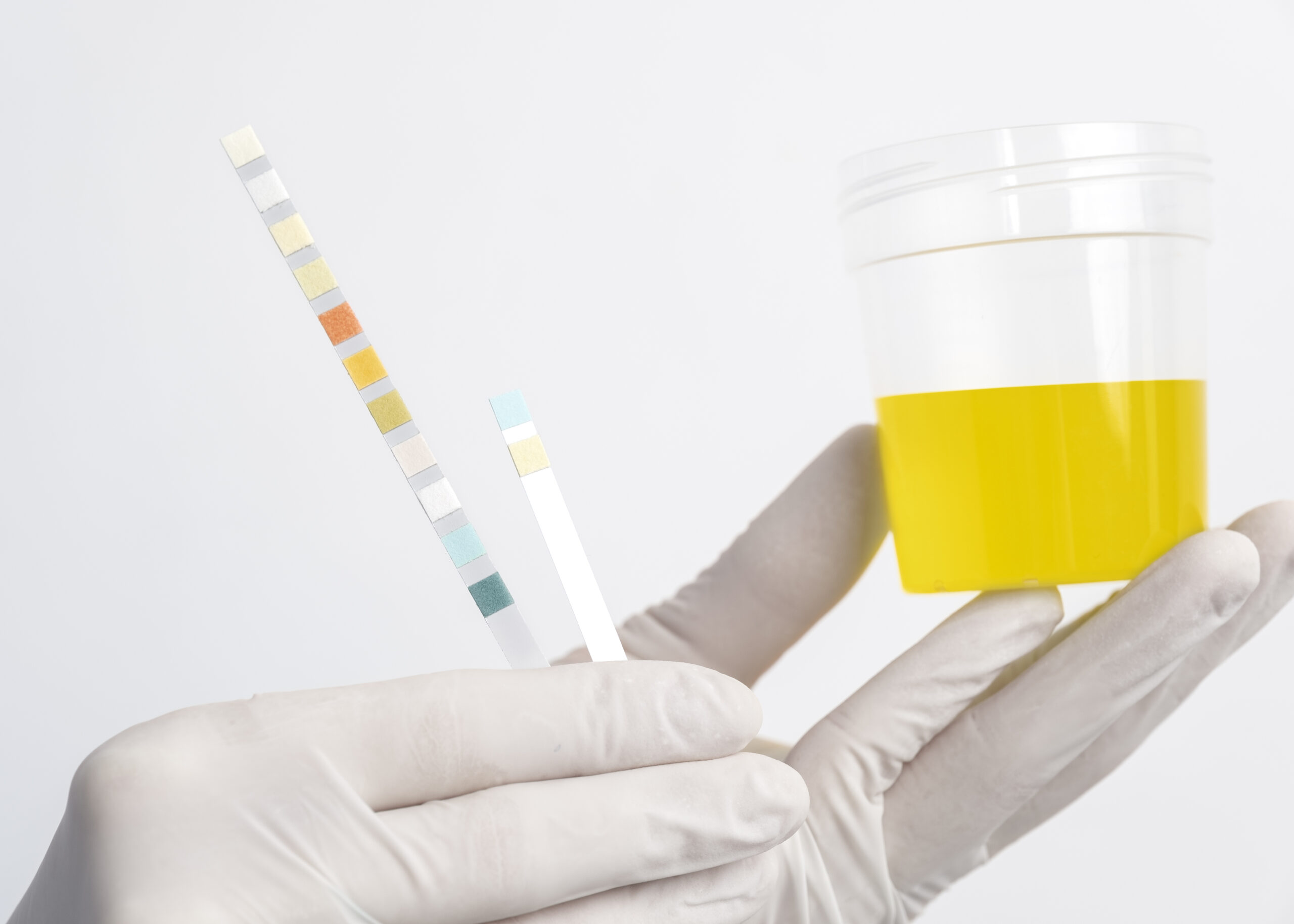 urine test